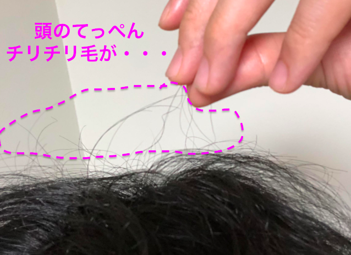 一部だけチリチリの髪の毛が生えてくる原因と対策について『メンズ編』 『くせ毛・剛毛・敏感肌のお悩みに直接答えるWebメディア』Men's